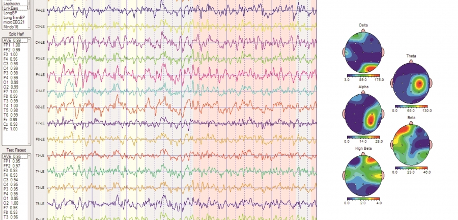 EEG / QEEG چیست؟